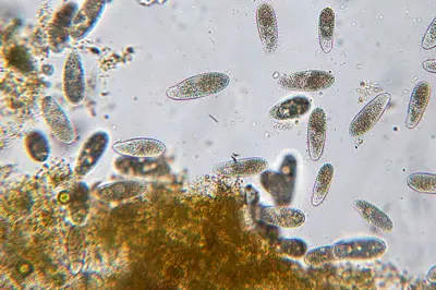 Image for Wissenschaft! Kinder lernen, dass Vaping die im Teich lebenden Protozoen tötet.